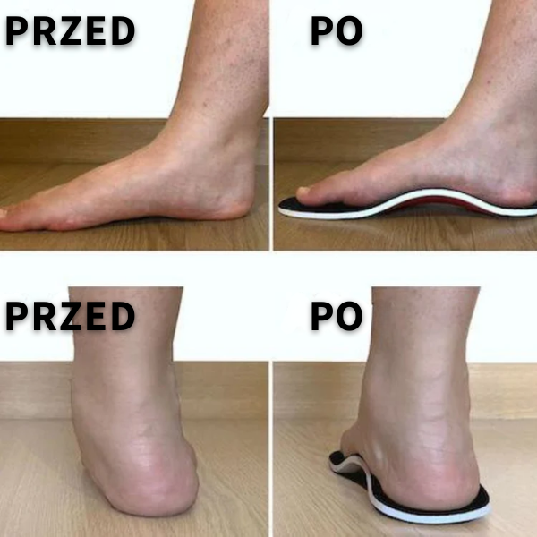 Profilowane ortopedyczne wkładki do butów - Centrum Ulgi